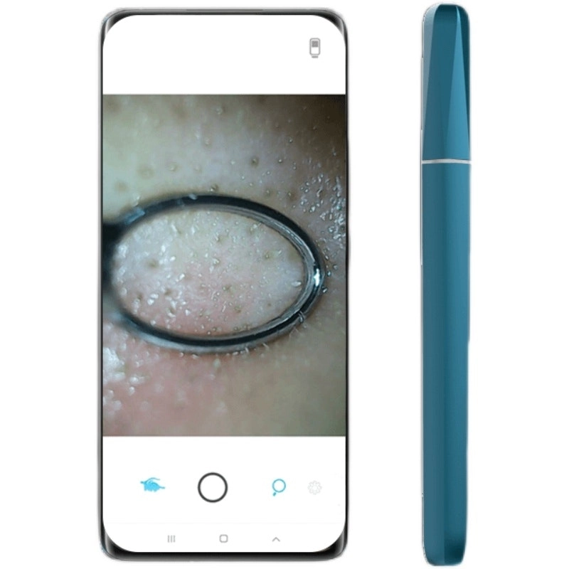 Intelligent APP Smart Visual Pore Cleaner Blackhead Remover Endoscope 200mAh Rechargeable Battery IP65